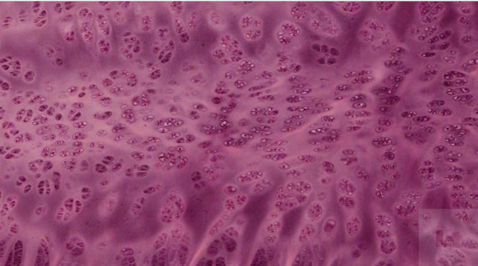 Hyaline Cartilage 400x Labeled